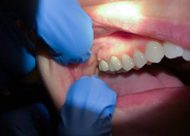 Best Pediatric Emergency Dentist in Montgomery, IN
